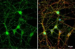 Anti-NF-M antibody [GT883] used in Immunocytochemistry/ Immunofluorescence (ICC/IF). GTX634483