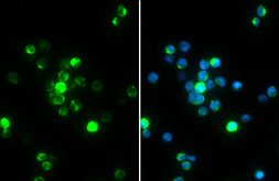 Anti-ZAP70 (phospho Tyr319) / Syk (phospho Tyr352) antibody [GT1686] used in Immunocytochemistry/ Immunofluorescence (ICC/IF). GTX634484