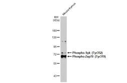 Anti-ZAP70 (phospho Tyr319) / Syk (phospho Tyr352) antibody [GT1686] used in Western Blot (WB). GTX634484