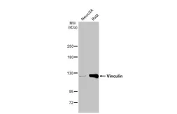 Anti-Vinculin antibody [GT3210] used in Western Blot (WB). GTX634535