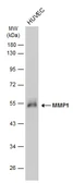 Anti-MMP1 antibody [GT2075] used in Western Blot (WB). GTX634537
