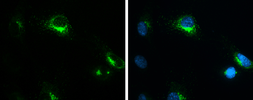 Anti-MMP1 antibody [GT2649] used in Immunocytochemistry/ Immunofluorescence (ICC/IF). GTX634538