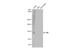 Anti-Rb antibody [2B5] used in Western Blot (WB). GTX634627