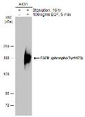 Anti-EGFR (phospho Tyr1173) antibody [GT1111] used in Western Blot (WB). GTX634793