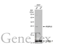 Anti-PGP9.5 antibody [GT448] used in Western Blot (WB). GTX634797
