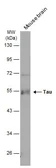 Anti-Tau antibody [GT287] used in Western Blot (WB). GTX634809