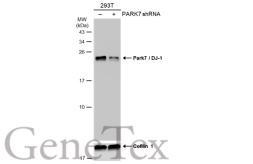 Anti-Park7 / DJ-1 antibody [GT1412] used in Western Blot (WB). GTX634811