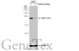 Anti-Park7 / DJ-1 antibody [GT353] used in Western Blot (WB). GTX634830