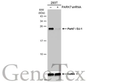 Anti-Park7 / DJ-1 antibody [GT136] used in Western Blot (WB). GTX634831