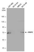 Anti-MMP2 antibody [GT185] used in Western Blot (WB). GTX634832