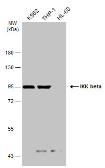 Anti-IKK beta antibody [GT685] used in Western Blot (WB). GTX634834