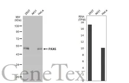 Anti-PAX6 antibody [GT9412] used in Western Blot (WB). GTX634863