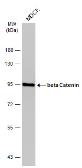 Anti-beta Catenin antibody [GT3171] - VetSignal used in Western Blot (WB). GTX634940