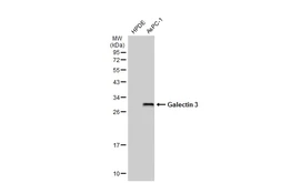 Anti-Galectin 3 antibody [GT1473] used in Western Blot (WB). GTX635151