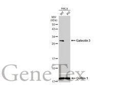 Anti-Galectin 3 antibody [GT12712] used in Western Blot (WB). GTX635155