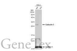 Anti-Galectin 3 antibody [GT1188] used in Western Blot (WB). GTX635156