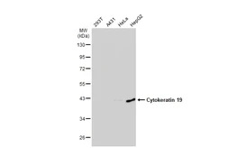 Anti-Cytokeratin 19 antibody [GT5810] used in Western Blot (WB). GTX635158