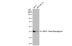 Anti-DAG1 / beta Dystroglycan antibody [GT9112] used in Western Blot (WB). GTX635178