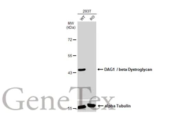 Anti-DAG1 / beta Dystroglycan antibody [GT835] used in Western Blot (WB). GTX635179