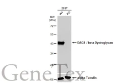Anti-DAG1 / beta Dystroglycan antibody [GT2812] used in Western Blot (WB). GTX635180