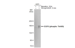 Anti-EGFR (phospho Thr669) antibody [GT1361] used in Western Blot (WB). GTX635205
