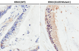 Anti-RAS (G12D Mutant) antibody [HL10] used in IHC (Paraffin sections) (IHC-P). GTX635362