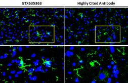 Anti-Iba1 antibody [HL22] used in IHC (Frozen sections) (IHC-Fr). GTX635363