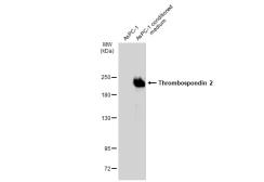 Anti-Thrombospondin 2 antibody [GT7511] used in Western Blot (WB). GTX635392