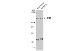 atm antibody 2c1 rb