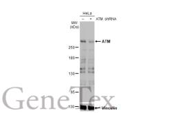 Anti-ATM antibody [2C1-RB] used in Western Blot (WB). GTX635395