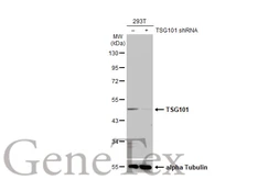 Anti-TSG101 antibody [4A10-RB] used in Western Blot (WB). GTX635396