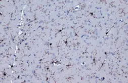 Anti-Iba1 antibody [HL22-RT] used in IHC (Paraffin sections) (IHC-P). GTX635400