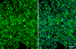 Anti-Iba1 antibody [HL22-RT] used in Immunocytochemistry/ Immunofluorescence (ICC/IF). GTX635400