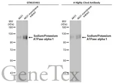 Anti-Sodium/Potassium ATPase alpha 1 antibody [HL114] used in Western Blot (WB). GTX635461