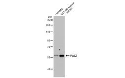 Anti-PAX3 antibody [HL160] used in Western Blot (WB). GTX635463