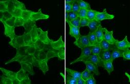 Anti-EpCAM antibody [GT852] used in Immunocytochemistry/ Immunofluorescence (ICC/IF). GTX635474