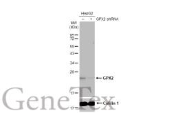 Anti-GPX2 antibody [HL125] used in Western Blot (WB). GTX635477