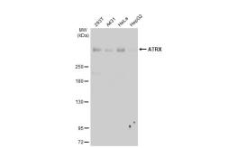 Anti-ATRX antibody [HL1210] used in Western Blot (WB). GTX635478