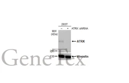 Anti-ATRX antibody [HL1210] used in Western Blot (WB). GTX635478