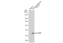 Anti-CTGF antibody [GT7812] used in Western Blot (WB). GTX635577