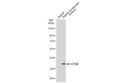Anti-CTGF antibody [GT8610] used in Western Blot (WB). GTX635578
