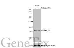 Anti-FACL4 antibody [HL229] used in Western Blot (WB). GTX635616