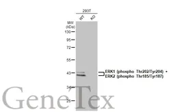 Anti-ERK1 (phospho Thr202/Tyr204) + ERK2 (phospho Thr185/Tyr187) antibody [HL173] used in Western Blot (WB). GTX635617