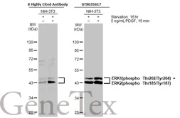 Anti-ERK1 (phospho Thr202/Tyr204) + ERK2 (phospho Thr185/Tyr187) antibody [HL173] used in Western Blot (WB). GTX635617