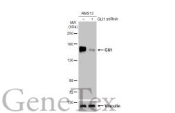 Anti-Gli1 antibody [HL247] used in Western Blot (WB). GTX635619