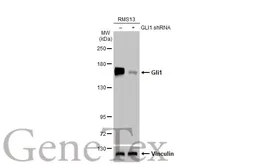 Anti-Gli1 antibody [HL247] used in Western Blot (WB). GTX635619