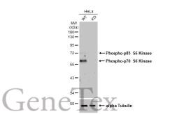 Anti-p70 S6K (phospho Thr421/Ser424) antibody [HL129] used in Western Blot (WB). GTX635621
