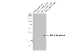 Anti-RAS (G12V Mutant) antibody [HL169] used in Western Blot (WB). GTX635623