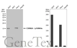 Anti-CDKN2A / p16INK4a antibody [GT1249] used in Western Blot (WB). GTX635638