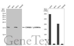 Anti-CDKN2A / p16INK4a antibody [GT888] used in Western Blot (WB). GTX635639